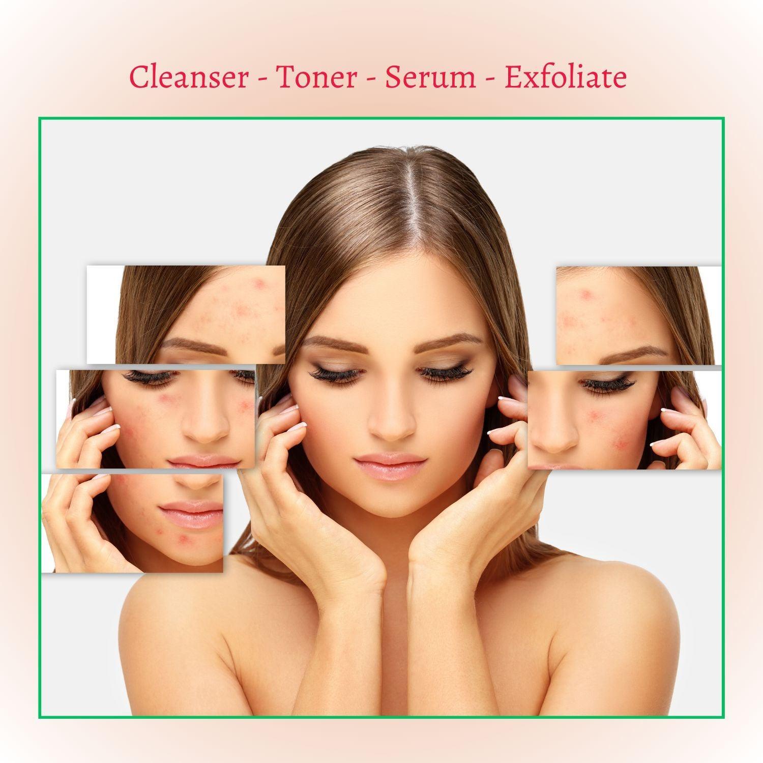 Deep Treatment Acne Cleansing Foam Cleanser