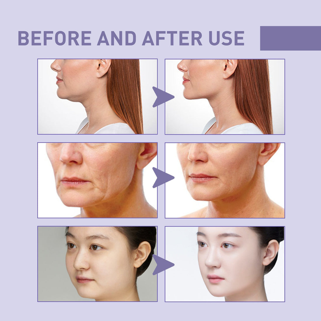 Firming Anti-Wrinkle Fading Invisible Lifting Tightening Mask