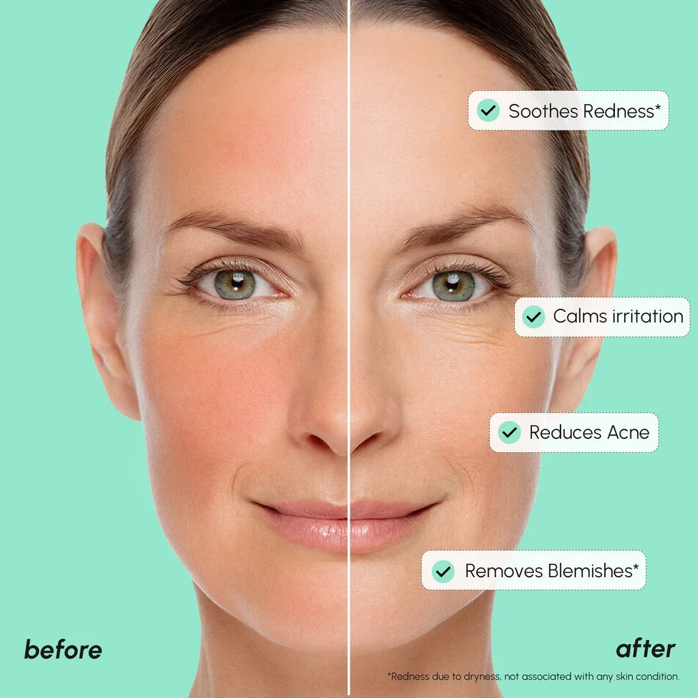 Marée®Redness Soothing Azelaic Acid Serum