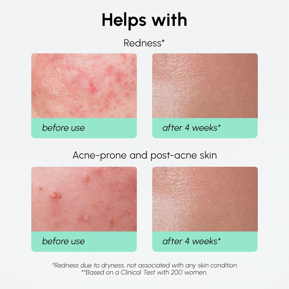 Marée®Redness Soothing Azelaic Acid Serum