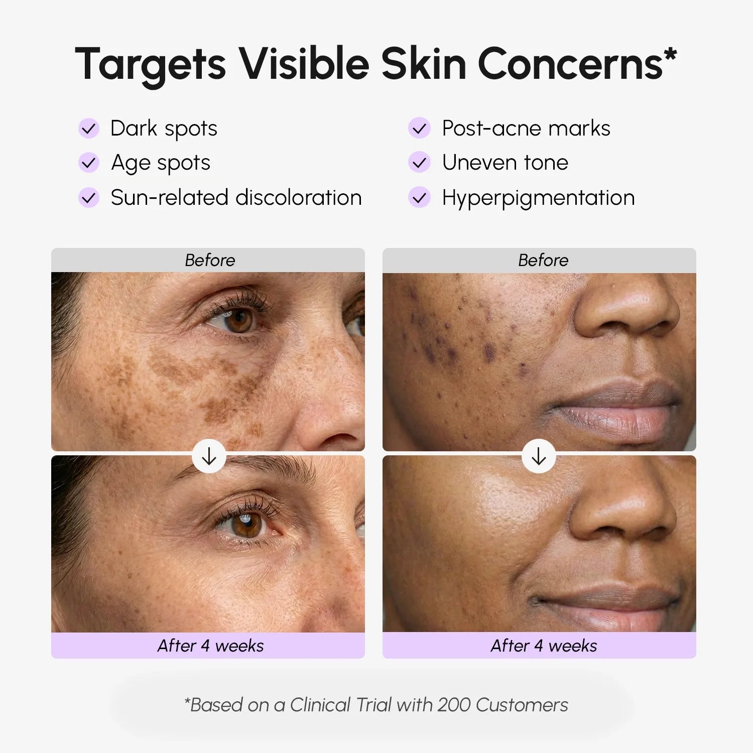 Marée®Face & Body Serum for Dark Spots