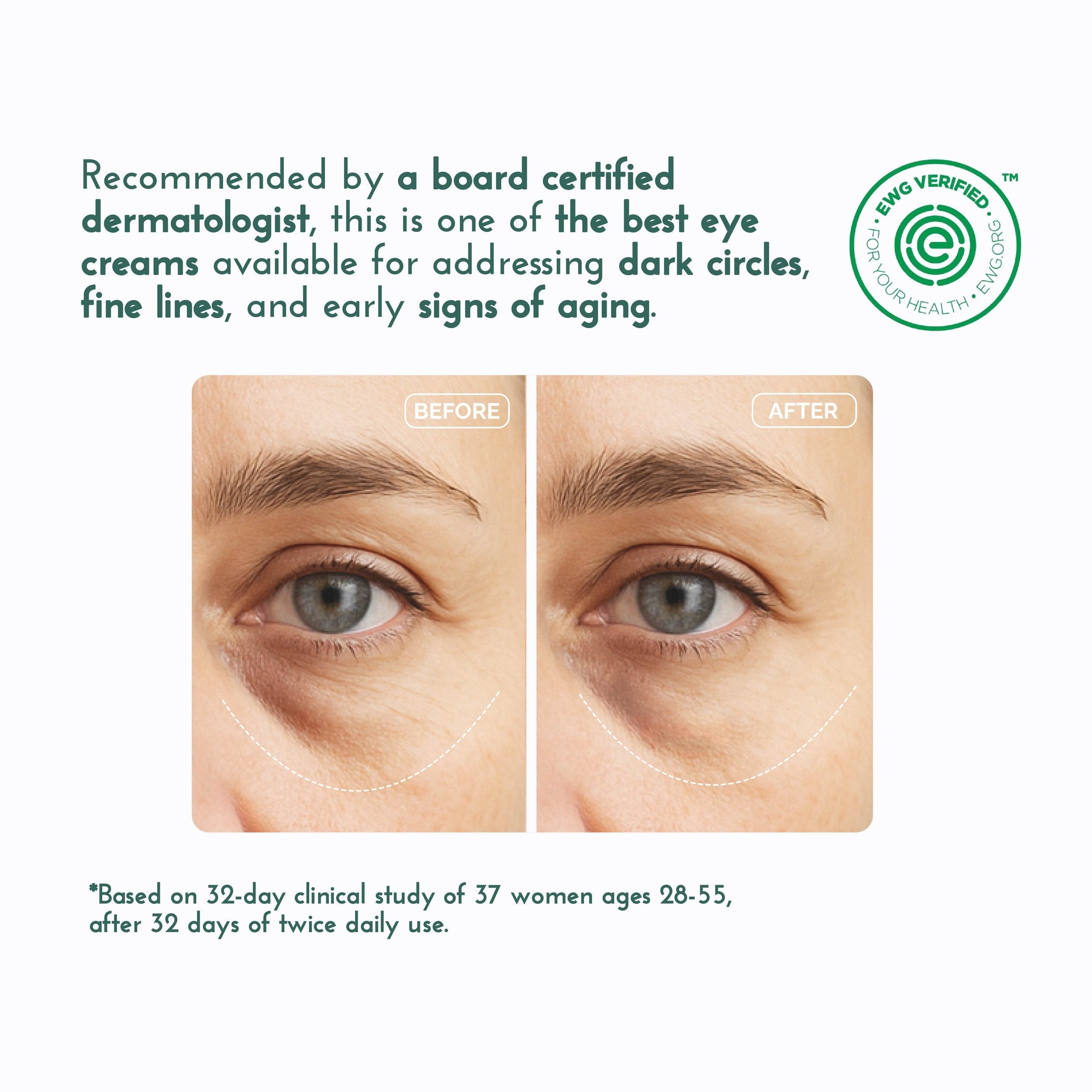 Anti-Aging Wrinkle Remover Eye & Neck Cream