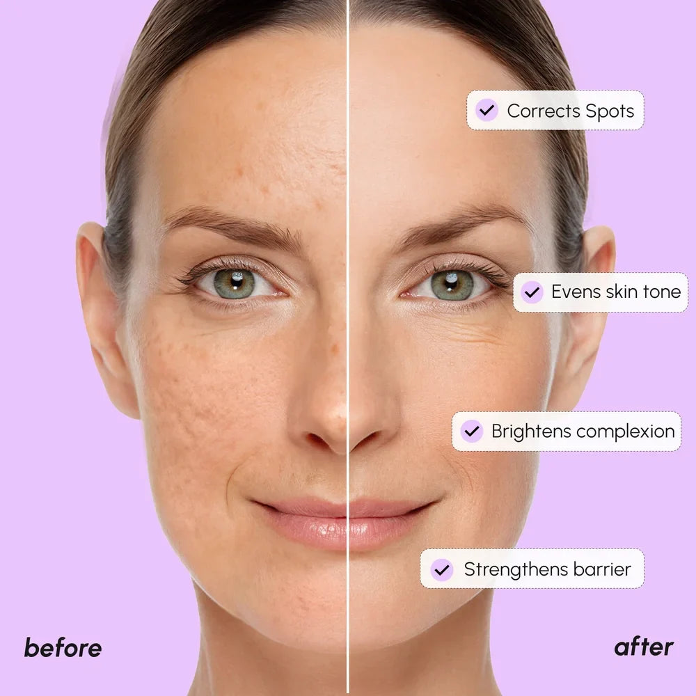 Marée® Tranexamic Acid Dark Spot Corrector
