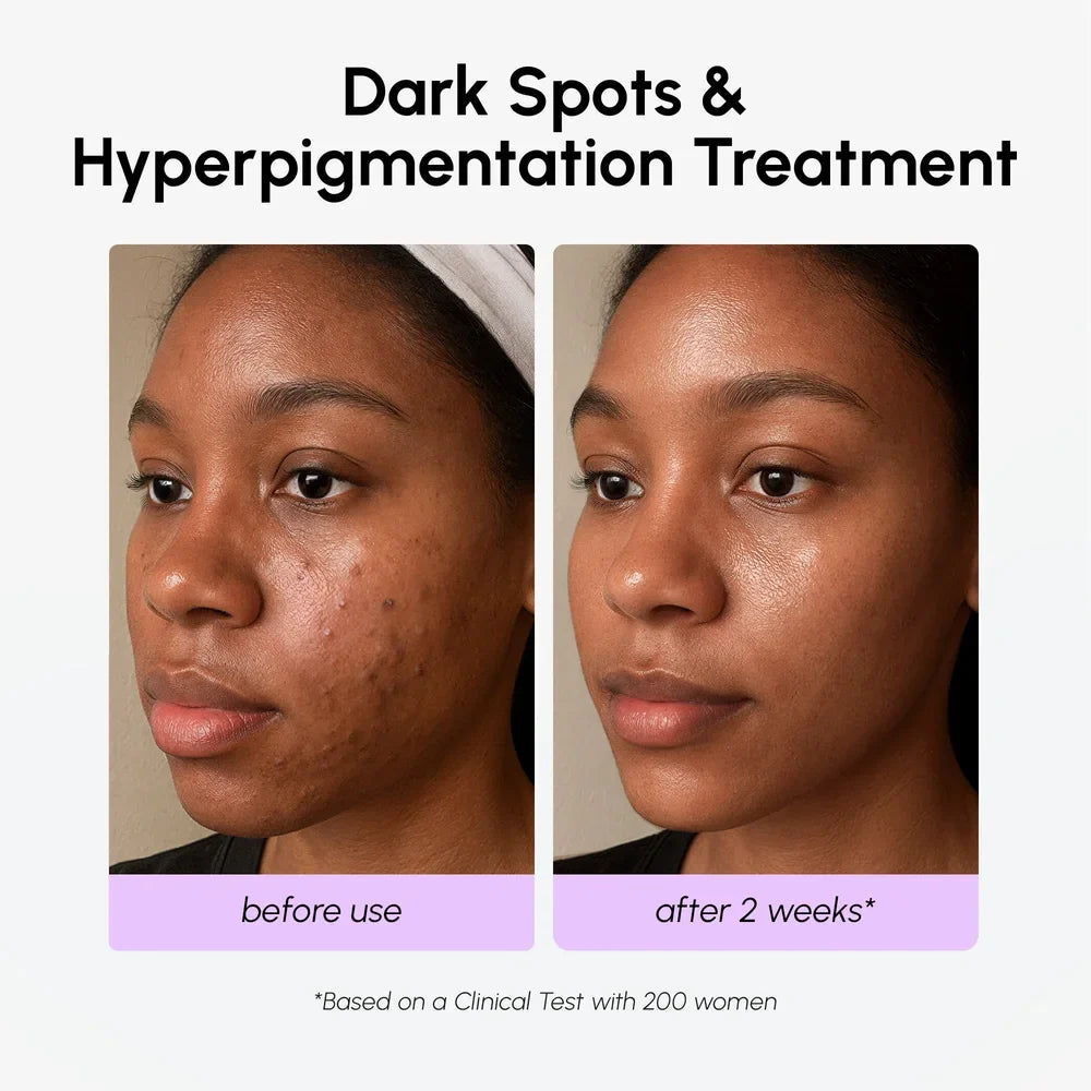 Marée® Tranexamic Acid Dark Spot Corrector