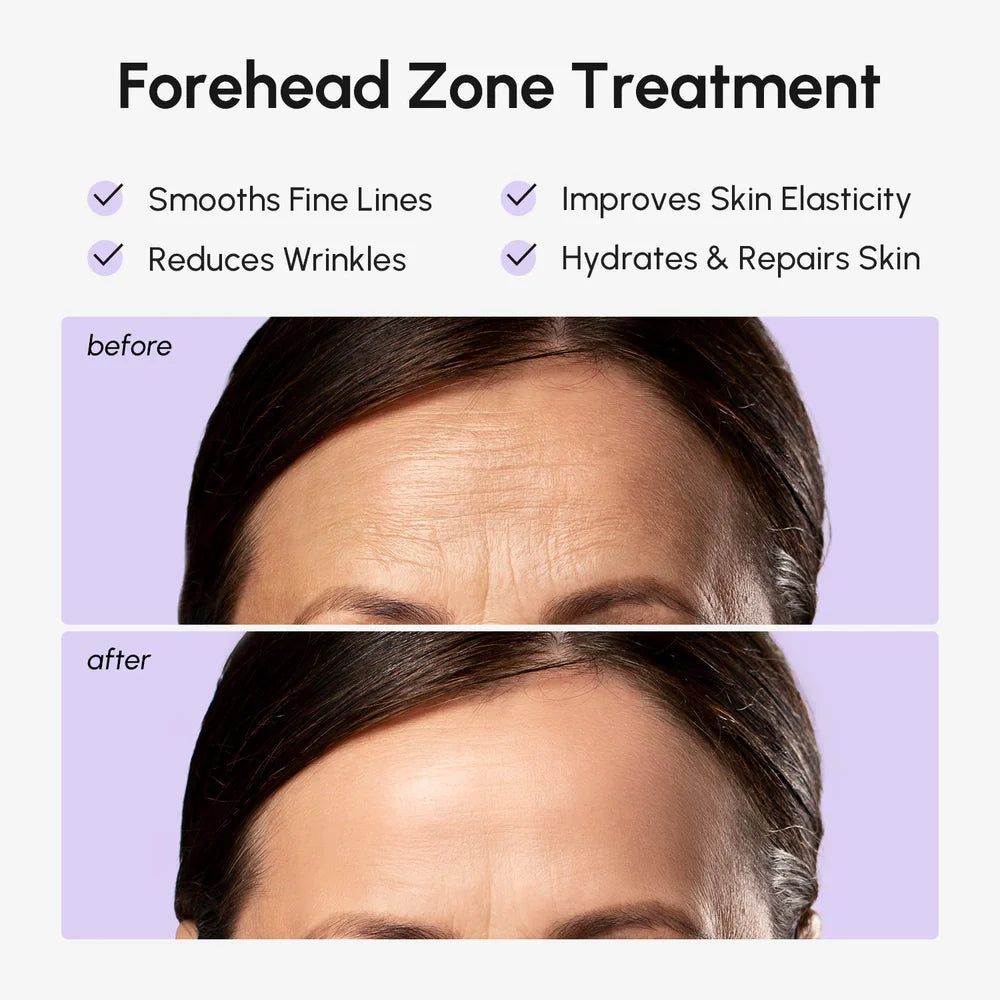 MAREE Anti-Wrinkle Forehead Patches