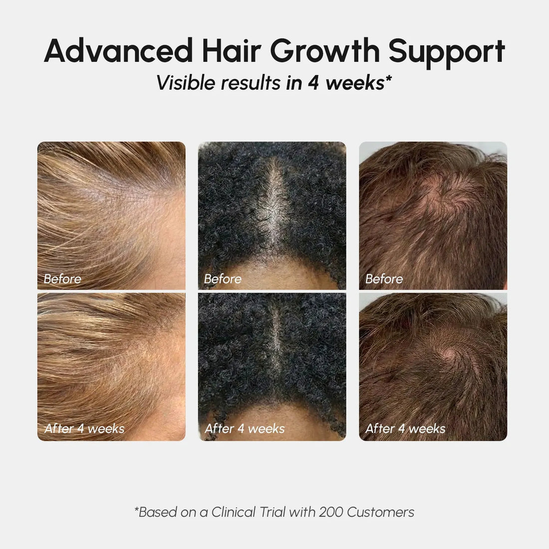 Marée® 4-in-1 Hair Growth Spray