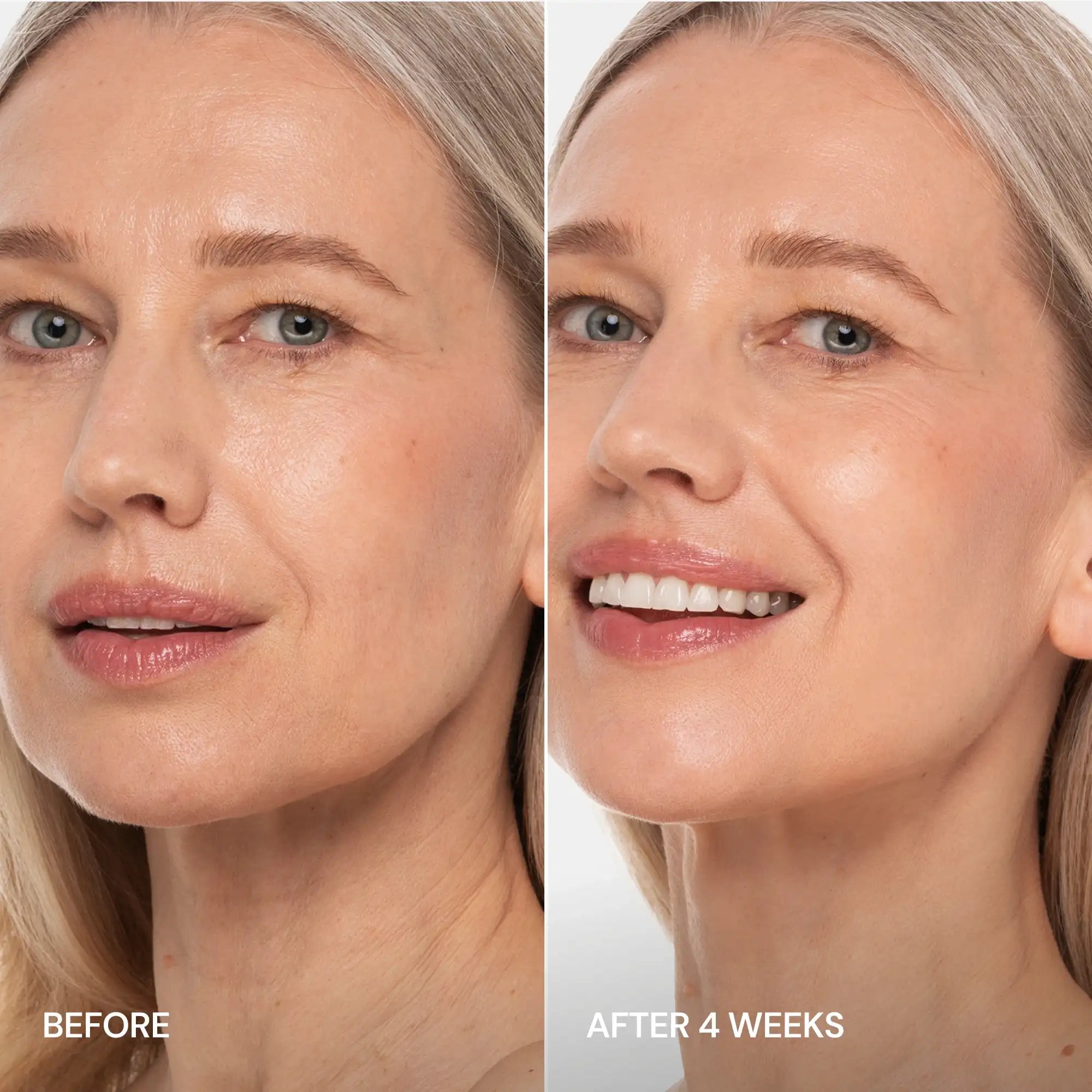 Marée® Pro-Retinol Neck Lifting Cream Massager