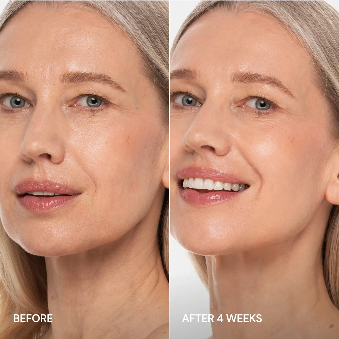 Marée® Pro-Retinol Neck Lifting Cream Massager