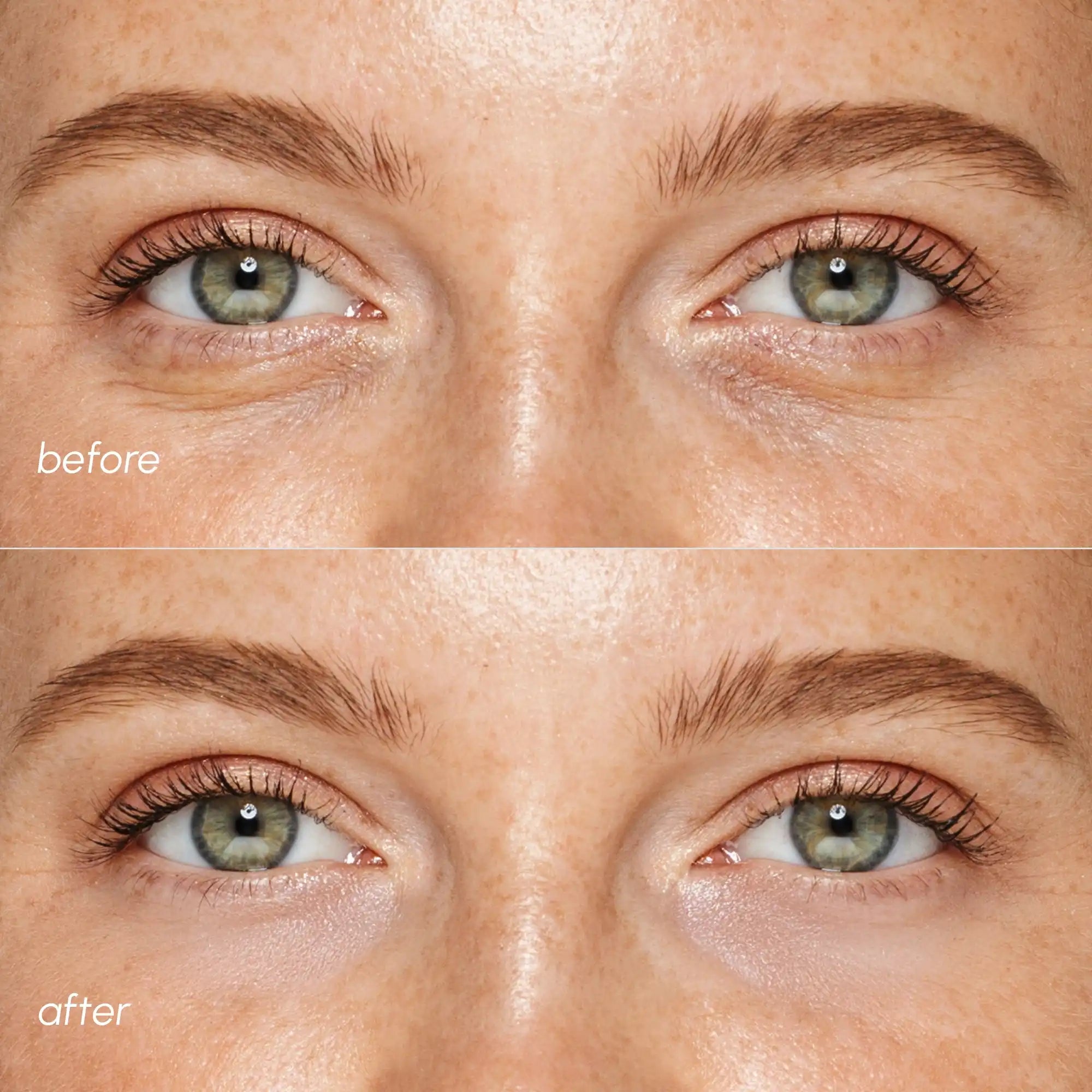 MAREE Pink Eye Patches for Puffy Eyes