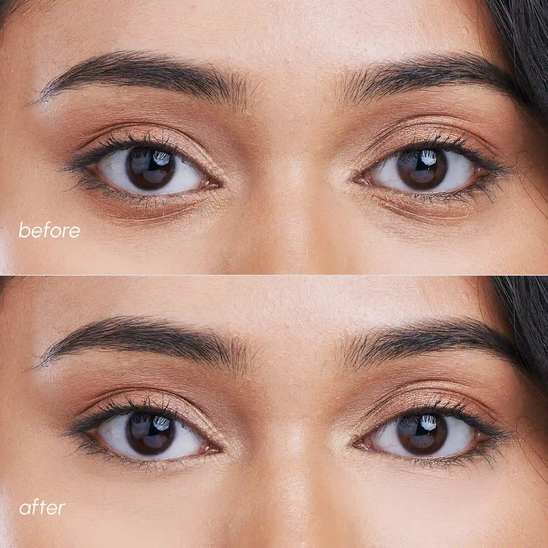MAREE Pink Eye Patches for Puffy Eyes