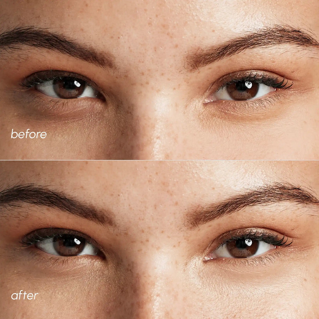 MAREE Pink Eye Patches for Puffy Eyes