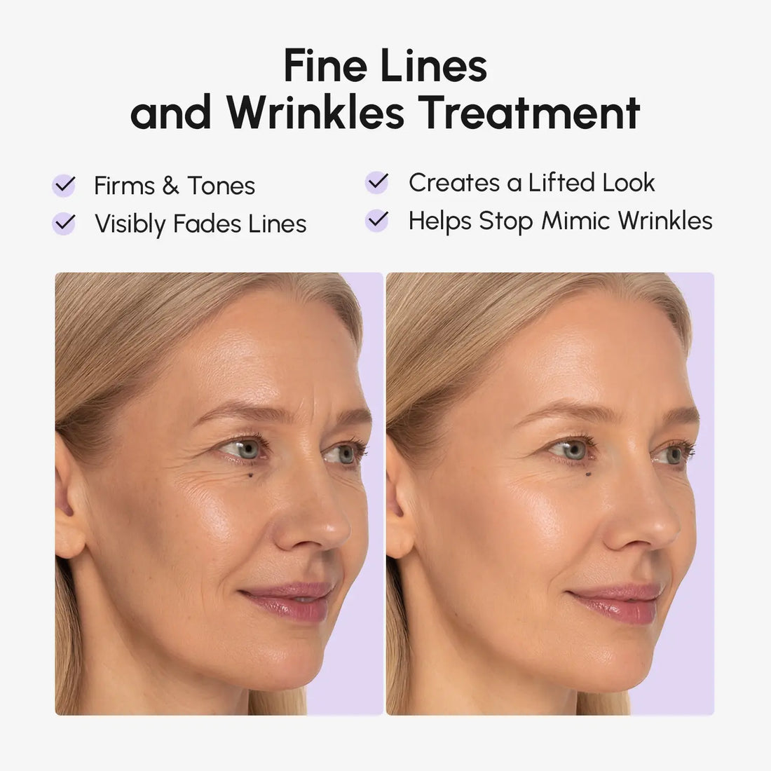 Marée® Anti-wrinkle Tape Patches