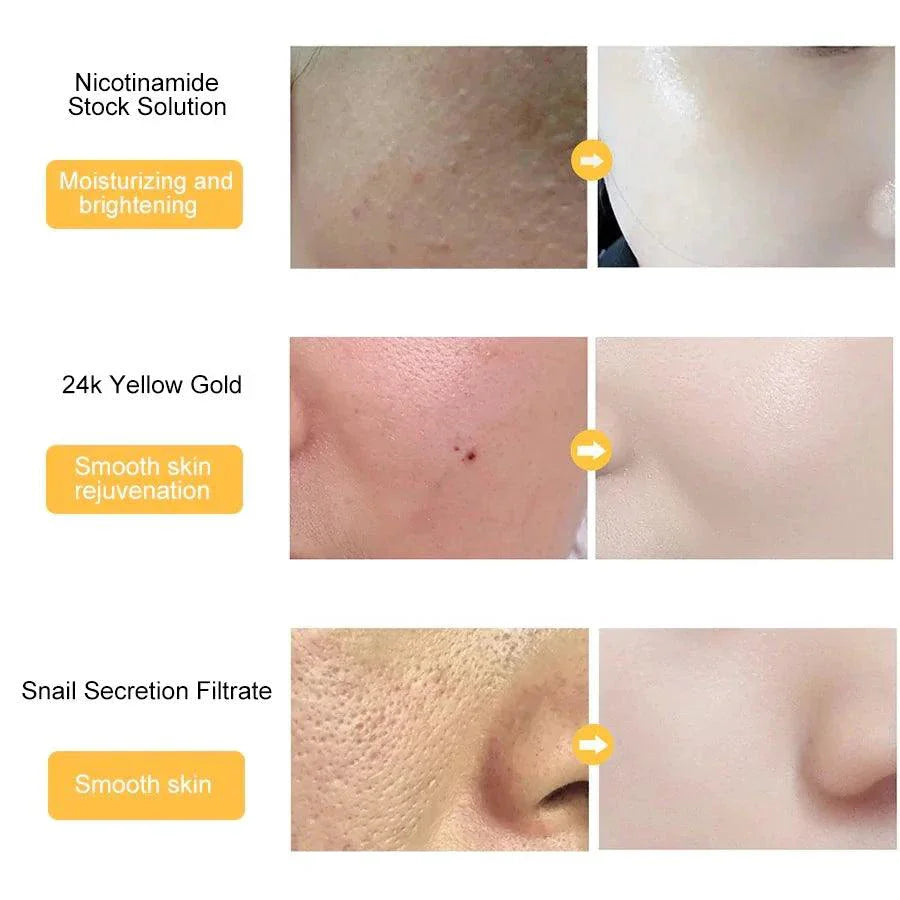Gold Essence Hyaluronic Serum with 24K Gold