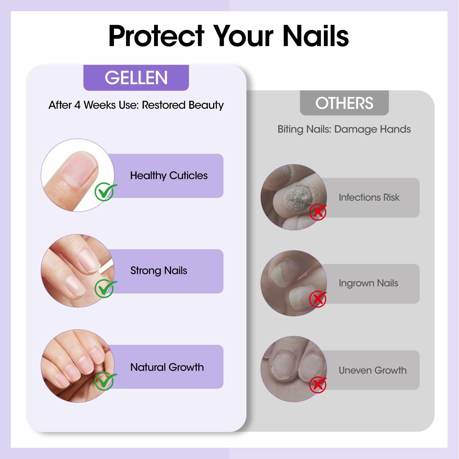 Nail Biting Treatment Roll-On 10ml Quick Dry Water-Resistant