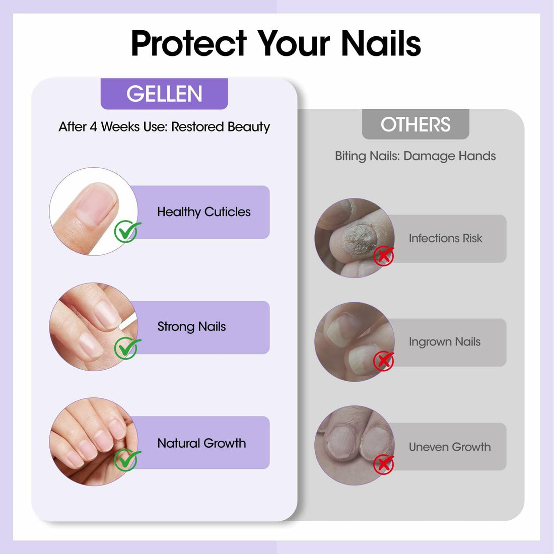 Nail Biting Treatment Roll-On 10ml Quick Dry Water-Resistant