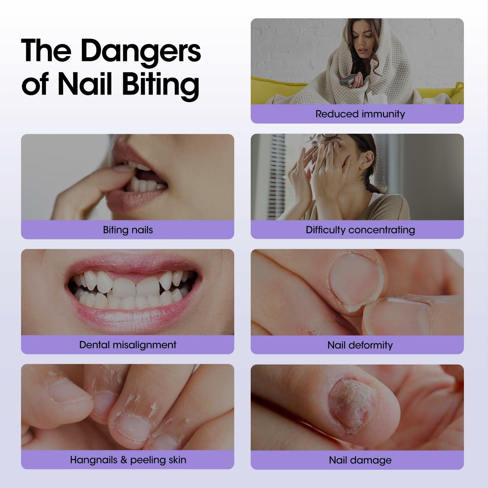 Nail Biting Treatment Roll-On 10ml Quick Dry Water-Resistant