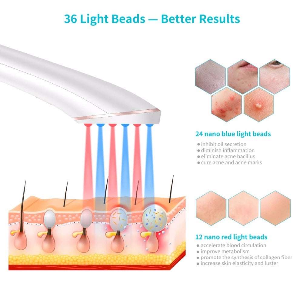 Acne Light Therapy Wireless Rechargeable Treatment Device