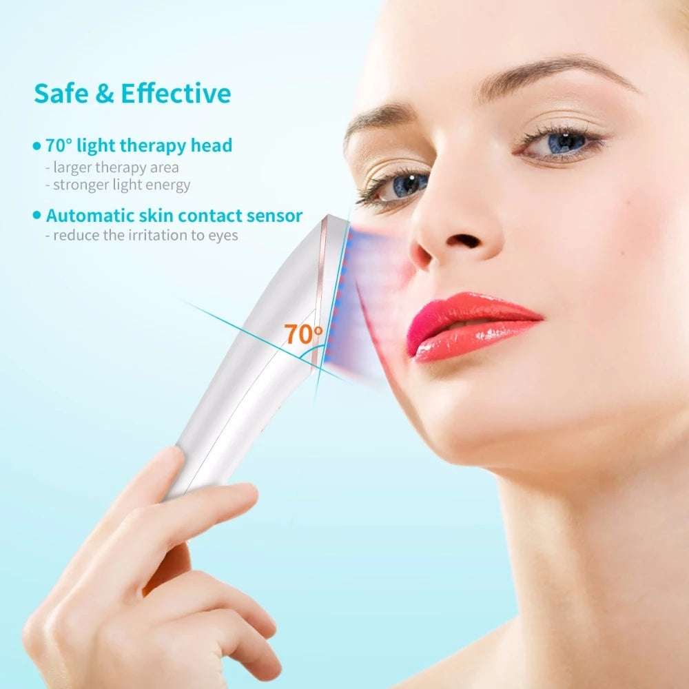 Acne Light Therapy Wireless Rechargeable Treatment Device