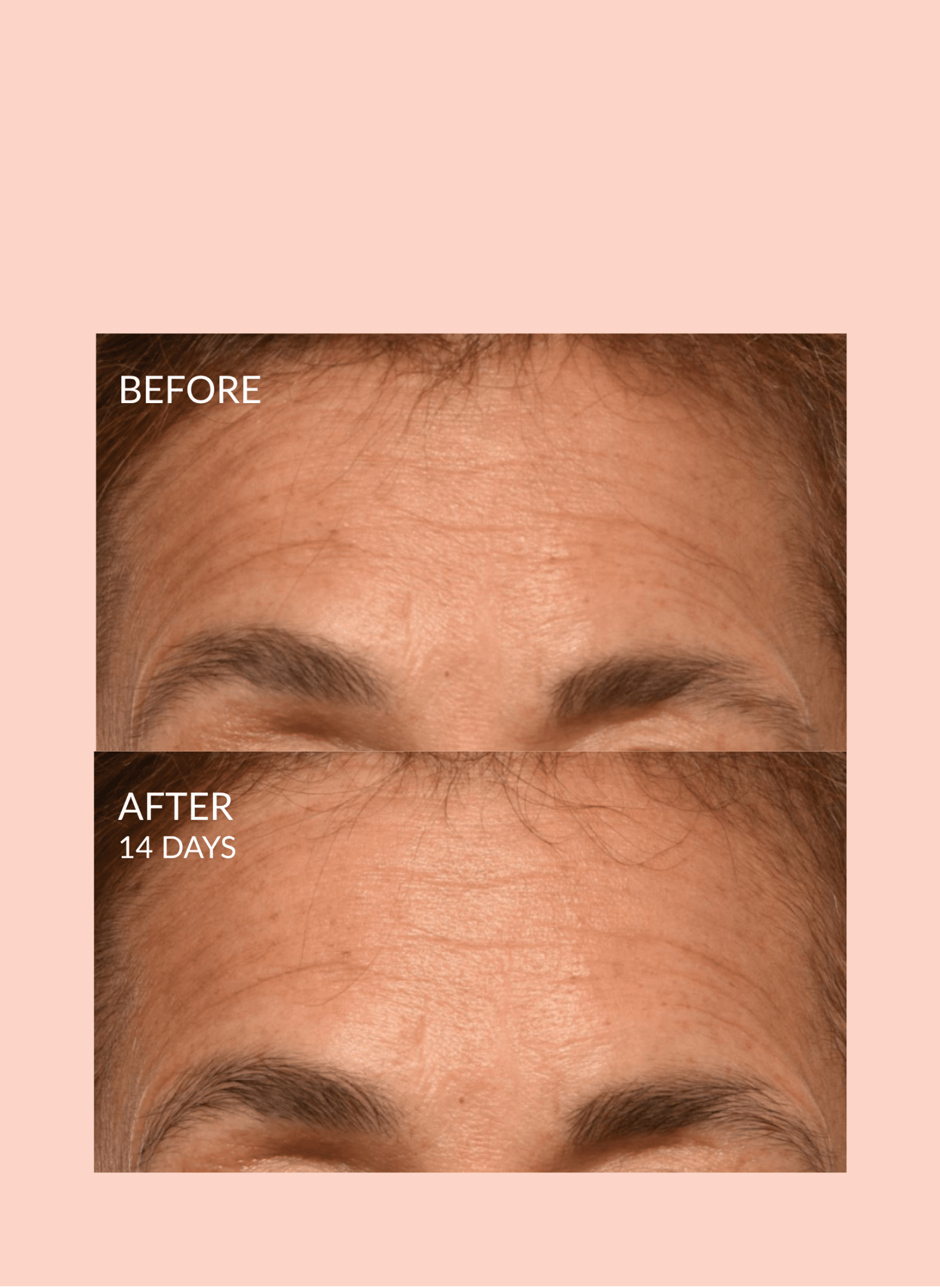 Caire Triple Lift Molecule Mask