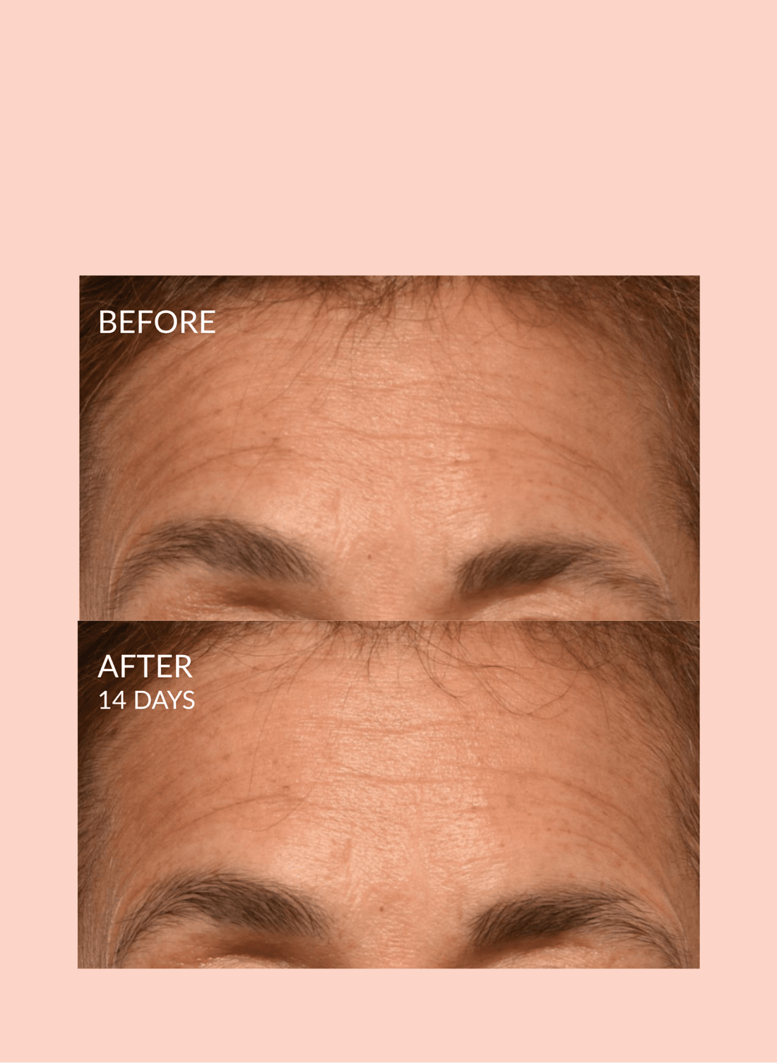Caire Triple Lift Molecule Mask